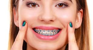 best dental clinic in Surat